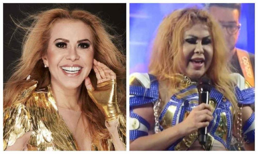 Rosto inchado de Joelma durante show preocupa fãs, e equipe explica