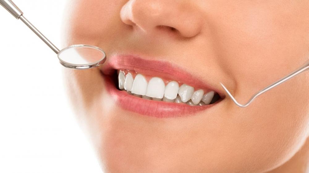 Lentes de contato garante sorriso perfeito por até 30 anos, garante dentista de Cuiabá