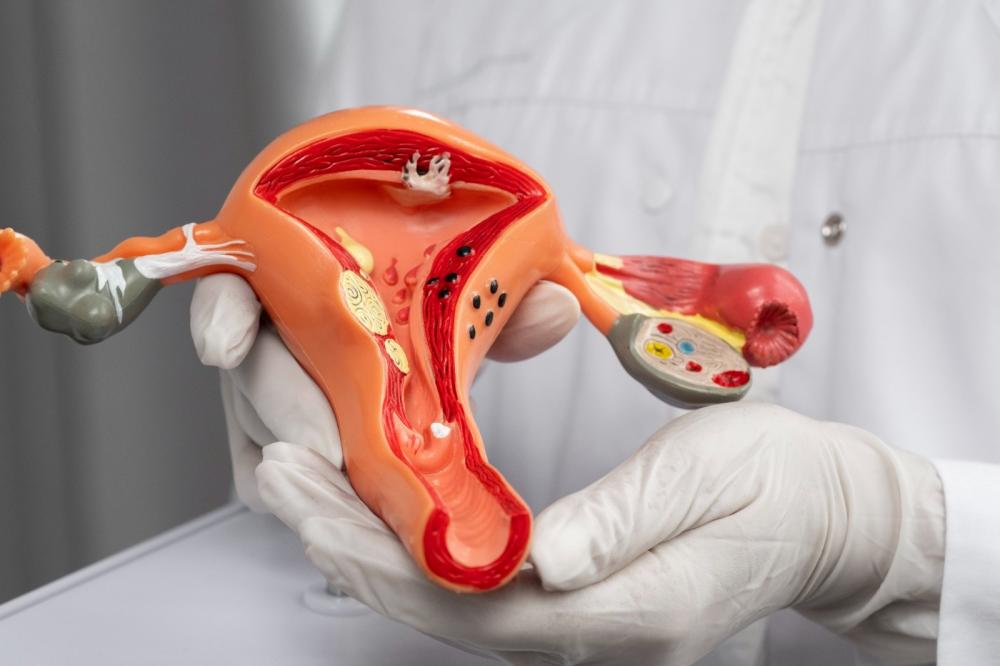 Endometriose afeta mais de 7 milhões de mulheres no Brasil 