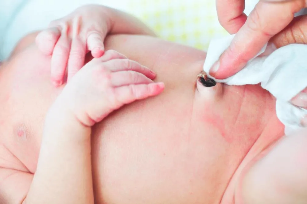 Pediatra orienta como fazer a limpeza correta do coto umbilical e alerta para sinais de infecção no recém-nascido