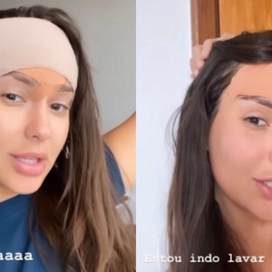 Thais Braz comenta sobre cirurgia para diminuir 2 cm da testa: 'Agonia'
